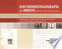Adult electroencephalography : a case-based bilingual English-Spanish atlas