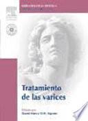 Alam, M., Tratamiento de las varices + DVD-Rom ©2007