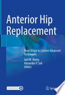Anterior Hip Replacement
