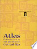 Atlas de Preparaciones en Prótesis Dental Fija