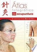 Atlas Fotografico de Acupuntura