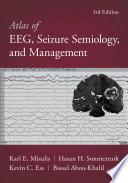 Atlas of EEG, Seizure Semiology, and Management