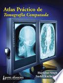 Atlas Práctico de Tomografia Computada