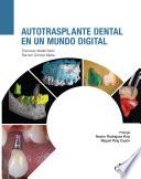 Autotrasplante dental en un mundo digital