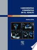 Cardiopatías Congénitas en el Adulto