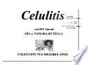 Celulitis