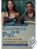 Cicatrices en mi piel