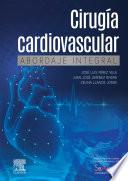 Cirugía cardiovascular. Abordaje integral