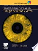 Cirugía de retina y vítreo