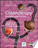 Colonoscopy