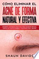 Cómo Eliminar el Acné de Forma Natural y Efectiva