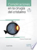 Complicaciones en la cirugía del cristalino