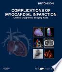 Complications of Myocardial Infarction