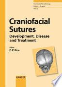 Craniofacial Sutures