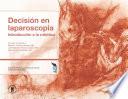 Decisión en Laparoscopia