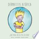 Dermatitis Atópica