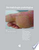 Dermatología podológica