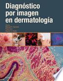 Diagnóstico por imagen en dermatología