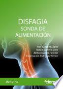 DISFAGIA. SONDA DE ALIMENTACIÓN
