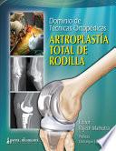 Dominio de Técnicas Ortopédicas: Artroplastía Total de Rodilla