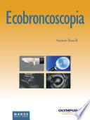 Ecobroncoscopia