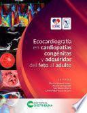 Ecocardiografía en Cardiopatías Congénitas y Adquiridas del Feto al Adulto