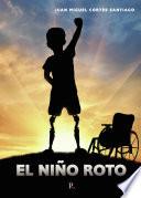 El niño roto