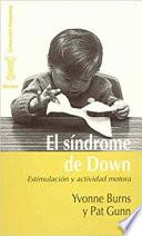 El síndrome de Down