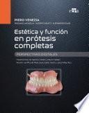 Estética y función en prótesis completas. Perspectivas digitales