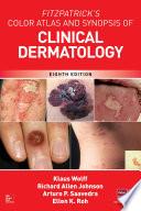 Fitzpatrick's Color Atlas and Synopsis of Clinical Dermatology, Eighth Edition