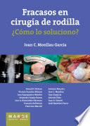 Fracasos en cirugía de rodilla