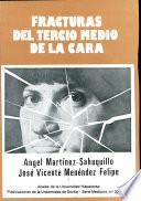 Fractura del tercio medio de la cara