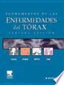 Fundamentos de las enfermedades del tórax