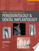 Hall's Critical Decisions in Periodontology & Dental Implantology, 5e