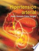Hipertensión arterial
