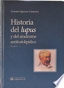 Historia del Lupus