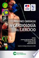 Imágenes Cardíacas en Cardiología del Ejercicio