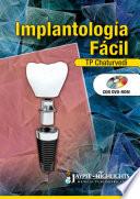 Implantología Fácil