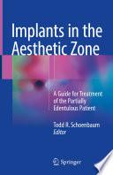 Implants in the Aesthetic Zone