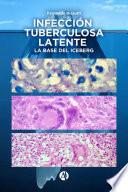 Infección Tuberculosa Latente, la base del iceberg