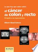 Lo que hay que saber sobre el cáncer de colon y recto.