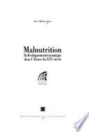 Malnutrition et développement économique dans l'Alsace du XIXe siècle