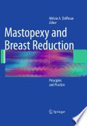 Mastopexy and Breast Reduction