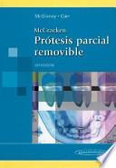 McCracken prótesis parcial removible