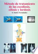 Método de tratamiento de las escoliosis, cifosis y lordosis