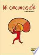 Mi circuncisión