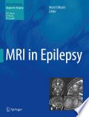 MRI in Epilepsy