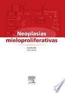 Neoplasias mieloproliferativas