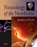 Neurology of the Newborn