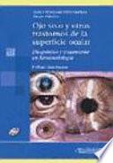 Ojo seco y otros trastornos de la superficie ocular